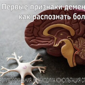 ПЕРВЫЕ ПРИЗНАКИ ДЕМЕНЦИИ: КАК РАСПОЗНАТЬ НАЧАЛО БОЛЕЗНИ - Средства массовой информации